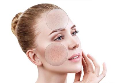 6 عادت صحیح برای تمیز کردن پوست های ترکیبی